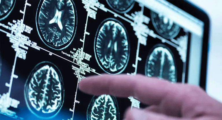 El cerebro atraviesa por cinco ‘etapas’, dicen científicos