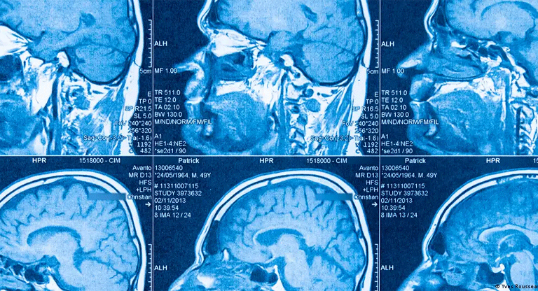 El cerebro humano no es uno, sino dos órganos